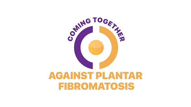 Plantar Fibromatosis